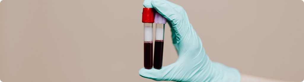 What Your Doctor’s Standard Blood Tests Miss: 15+ Biomarkers You’re Rarely Tested For
